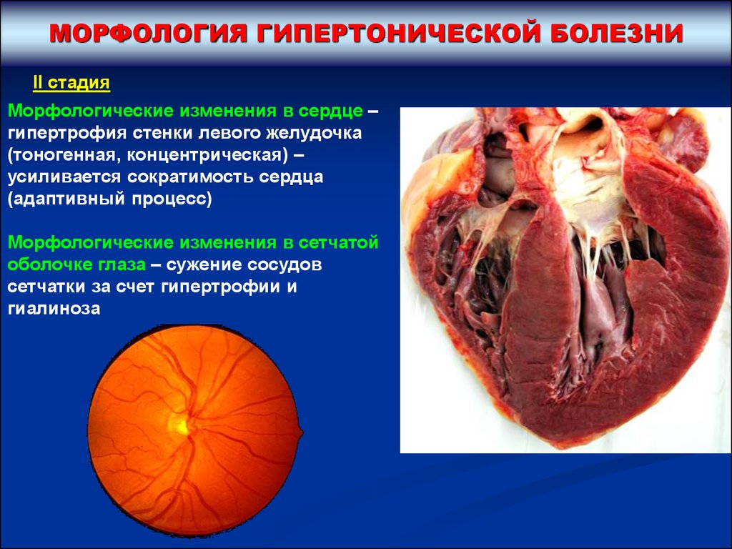 С чем связаны изменения в сердце С чем связаны изменения в сердце