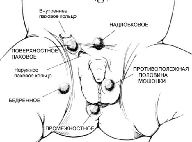 Яички где находится Яички где находится