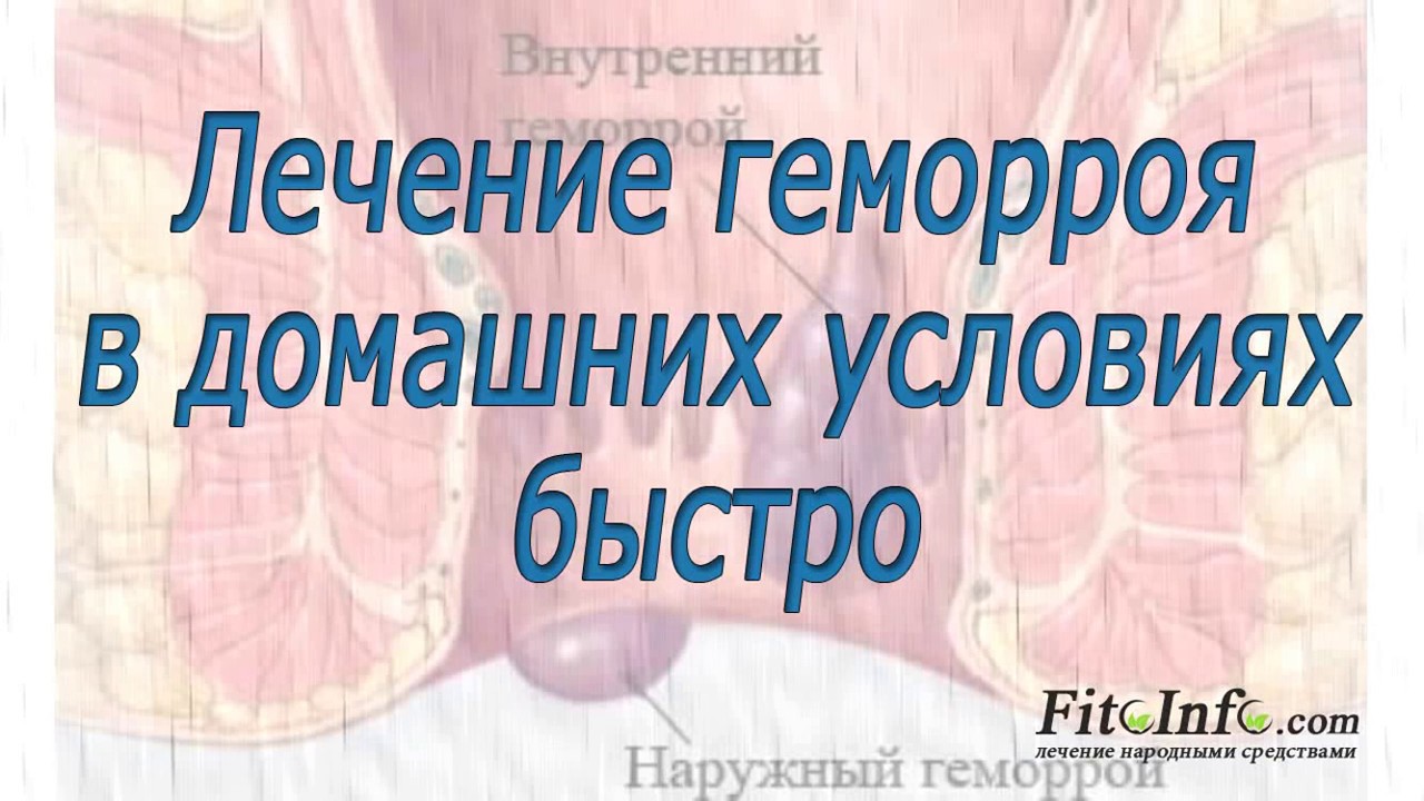 Лечения кровоточащего геморроя в домашних условиях