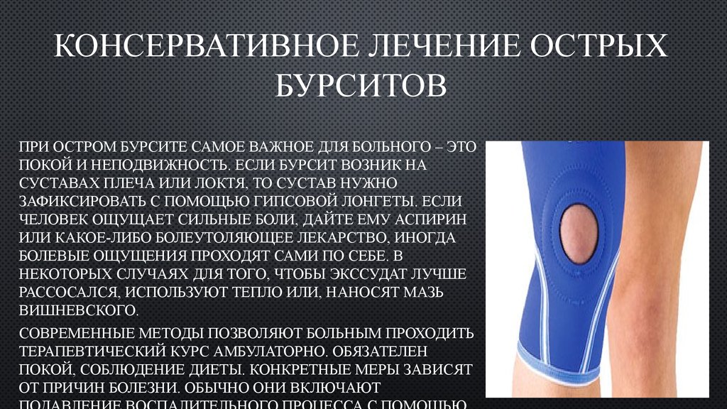 Методы лечения бурсита локтевого сустава Методы лечения бурсита локтевого сустава