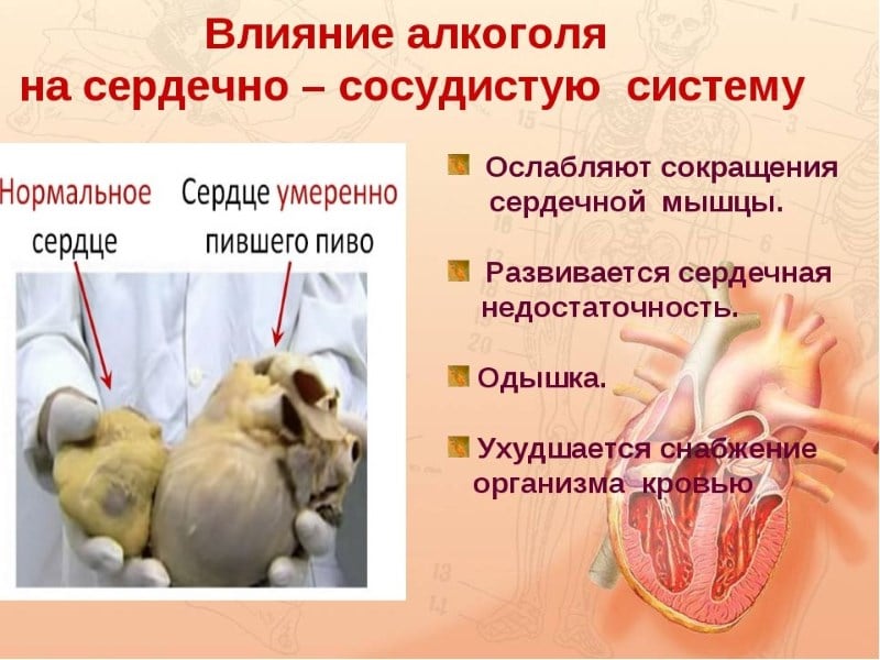 Позвоночник влияние алкоголя на Позвоночник влияние алкоголя на