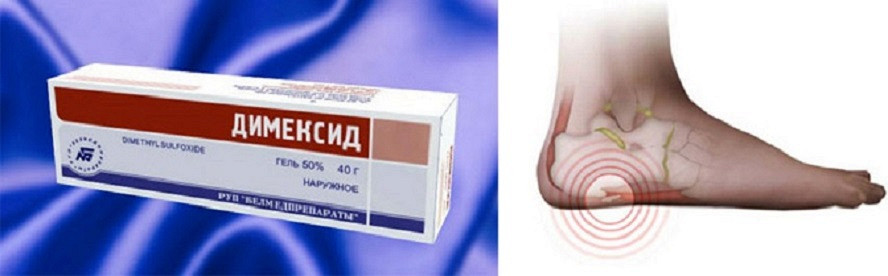 Лечение димексидом коленных суставов Лечение димексидом коленных суставов