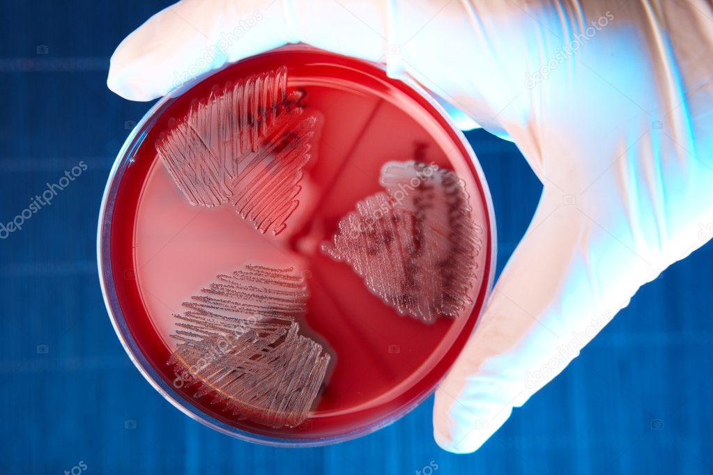 Streptococcus agalactiae у мужчин как лечить Streptococcus agalactiae у мужчин как лечить