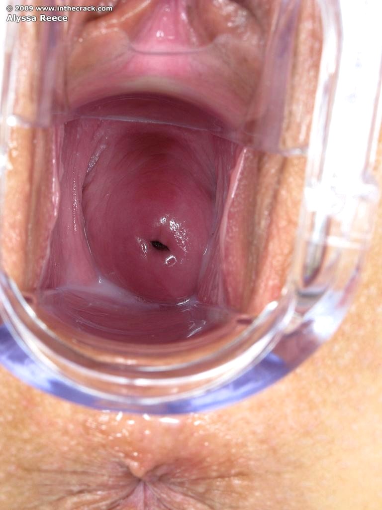 Женские половые органы фото гинекология