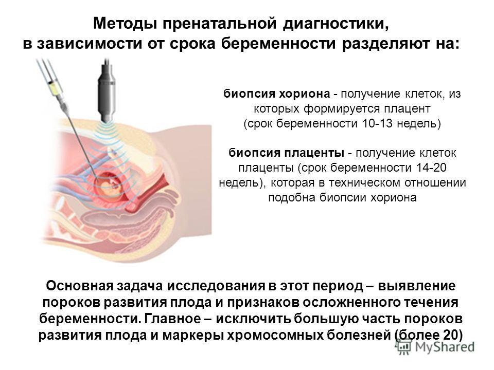 История болезни гинекология внематочная беременность